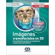 IMAGENES CRANEOFACIALES EN 3D. PROCEDIMIENTOS ACTUALES EN ORTODONCIA, CIRUGIA ORAL Y MAXILOFACIALl