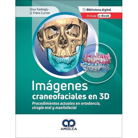IMAGENES CRANEOFACIALES EN 3D. PROCEDIMIENTOS ACTUALES EN ORTODONCIA, CIRUGIA ORAL Y MAXILOFACIALl