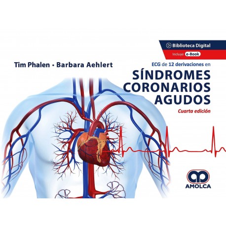 ECG DE 12 DERIVACIONES EN SINDROMES CORONARIOS AGUDOS
