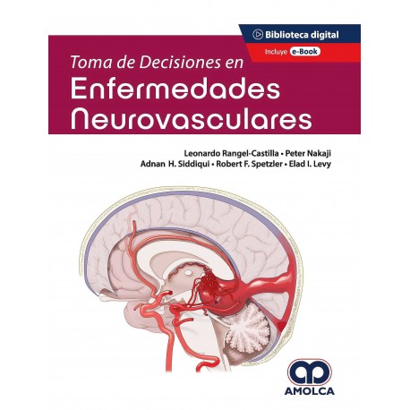 TOMA DEDECISIONES EN ENFERMEDADES NEUROVASCULARES