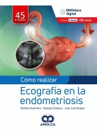 COMO REALIZAR ECOGRAFIA EN LA ENDOMETRIOSIS