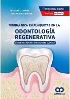 FIBRA RICA EN PLAQUETAS EN LA ODONTOLOGIA REGENERATIVA