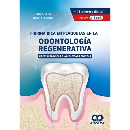 FIBRA RICA EN PLAQUETAS EN LA ODONTOLOGIA REGENERATIVA