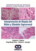 INTERPRETACION DE BIOPSIA DEL RIÑON Y GLANDULA SUPRARRENAL (INTERPRETACION DE BIOPSIAS)