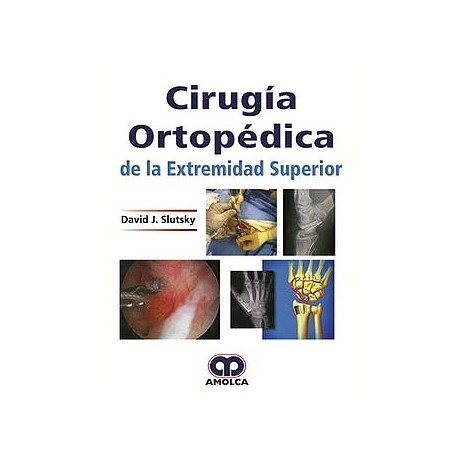 CIRUGIA ORTOPEDICA DE LA EXTREMIDAD SUPERIOR