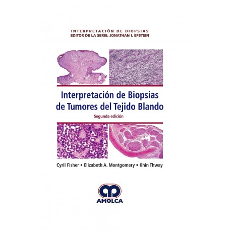 INTERPRETACION DE BIOPSIAS DE TUMORES DE TEJIDO BLANDO