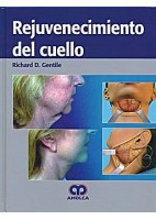 REJUVENECIMIENTO DEL CUELLO