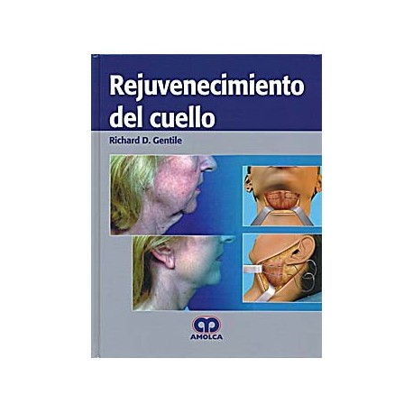 REJUVENECIMIENTO DEL CUELLO