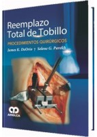 REEMPLAZO TOTAL DE TOBILLO