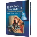 REEMPLAZO TOTAL DE TOBILLO