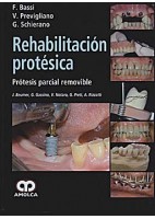 REHABILITACION PROTESICA. PROTESIS PARCIAL REMOVIBLE