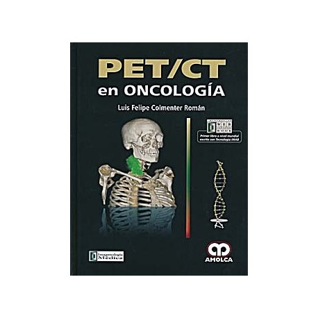 PET/CT EN ONCOLOGIA