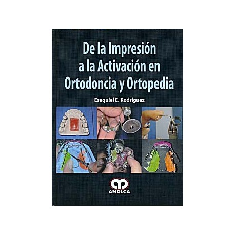 DE LA IMPRESION A LA ACTIVACION EN ORTODONCIA Y ORTOPEDIA