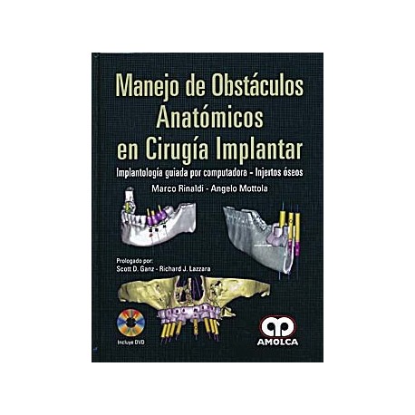 MANEJO DE OBSTACULOS ANATOMICOS EN CIRUGIA IMPLANTAR + DVD