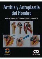 ARTRITIS Y ARTROPLASTIA DEL HOMBRO + DVD