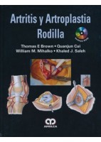 ARTRITIS Y ARTROPLASTIA DE RODILLA + DVD