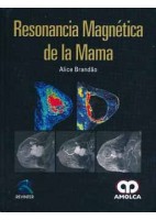 RESONANCIA MAGNETICA DE LA MAMA