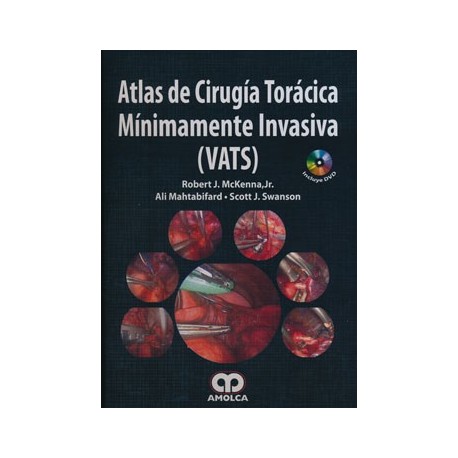 ATLAS DE CIRUGIA TORACICA MINIMAMENTE INVASIVA (VATS) + DVD