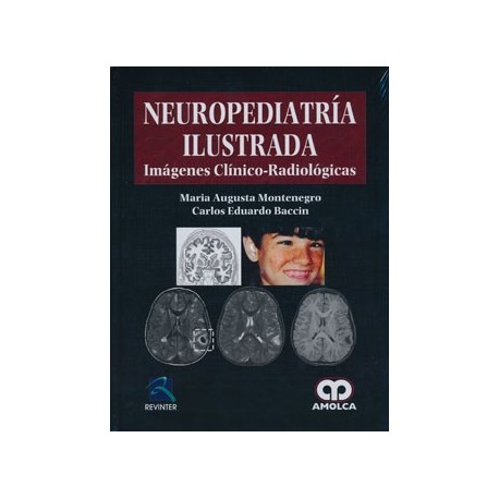 NEUROPEDIATRIA ILUSTRADA. IMAGENES CLINICO-RADIOLOGICAS