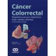 CANCER COLORRECTAL. DIAGNOSTICO PRECOZ Y TRATAMIENTO