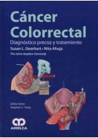 CANCER COLORRECTAL. DIAGNOSTICO PRECOZ Y TRATAMIENTO