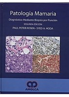 PATOLOGIA MAMARIA DIAGNOSTICO MEDIANTE BIOPSIA POR PUNCION