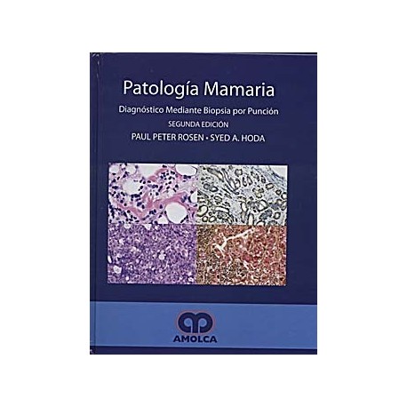 PATOLOGIA MAMARIA DIAGNOSTICO MEDIANTE BIOPSIA POR PUNCION