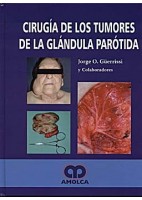 CIRUGIA DE LOS TUMORES DE LA GLANDULA PAROTIDA