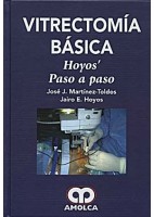 VITRECTOMIA BASICA. HOYOS. PASO A PASO