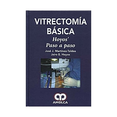 VITRECTOMIA BASICA. HOYOS. PASO A PASO