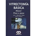 VITRECTOMIA BASICA. HOYOS. PASO A PASO