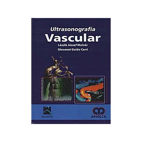 ULTRASONOGRAFIA VASCULAR
