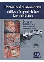 EL NERVIO FACIAL EN LA MICROCIRUGIA DEL HUESO TEMPORAL Y LA BASE LATERAL DEL CRANEO
