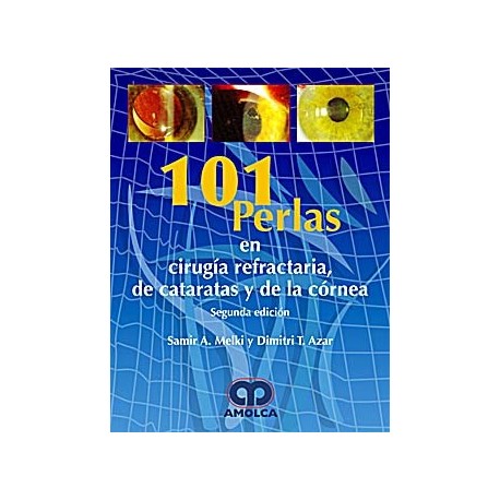 101 PERLAS EN CIRUGIA REFRACTARIA DE CATARATAS Y DE LA CORNEA