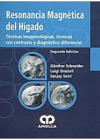 RESONANCIA MAGNETICA DEL HIGADO
