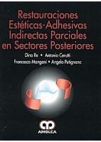RESTAURACIONES ESTETICAS-ADHESIVAS INDIRECTAS PARCIALES EN SECTORES POSTERIORES