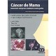 CANCER DE MAMA Â¬  DETECCION TEMPRANA MEDIANTE MAMOGRAFIA