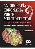 ANGIOGRAFIA CORONARIA POR TC MULTIDETECTOR. PRINCIPIOS, PRACTICA Y APLICACIONES