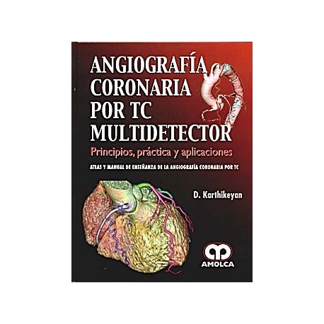 ANGIOGRAFIA CORONARIA POR TC MULTIDETECTOR. PRINCIPIOS, PRACTICA Y APLICACIONES