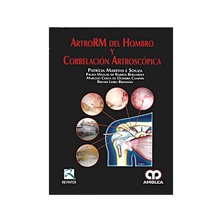 ARTRORM DEL HOMBRO Y CORRELACIÃ N ARTROSCÃ PICA