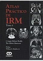 ATLAS PRACTICO DE IRM, 2 VOLS.