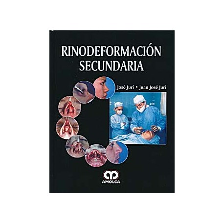 RINODEFORMACION SECUNDARIA