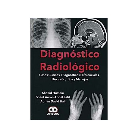 DIAGNOSTICO RADIOLOGICO. CASOS CLINICOS, DIAGNOSTICOS DIFERENCIALES, DISCUSION, TIPS Y MANEJOS