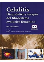 CELULITIS. DIAGNOSTICO Y TERAPIA DEL FIBROEDEMA EVOLUTIVO FEMENINO