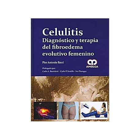 CELULITIS. DIAGNOSTICO Y TERAPIA DEL FIBROEDEMA EVOLUTIVO FEMENINO