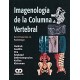 IMAGENOLOGIA DE LA COLUMNA VERTEBRAL