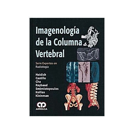 IMAGENOLOGIA DE LA COLUMNA VERTEBRAL