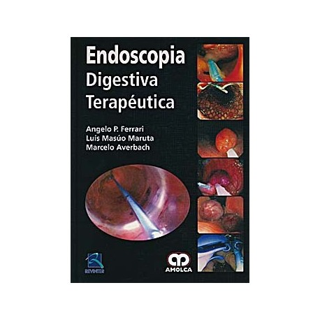 ENDOSCOPIA DIGESTIVA TERAPEUTICA