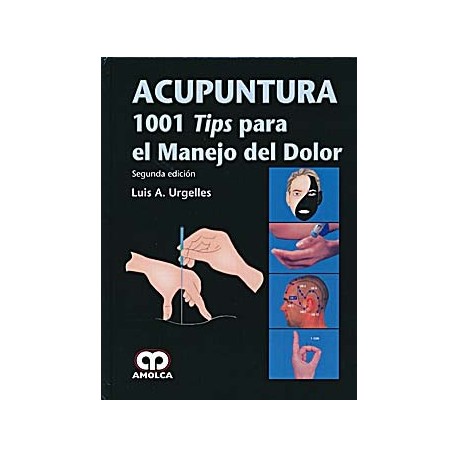 ACUPUNTURA. 1001 TIPS PARA EL MANEJO DEL DOLOR