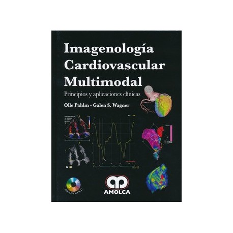 IMAGENOLOGIA CARDIOVASCULAR MULTIMODAL. PRINCIPIOS Y APLICACIONES CLINICAS + DVD